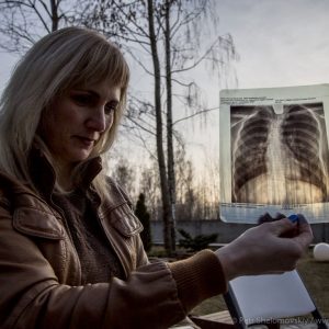 Galina Sviridenko shows an x-ray photograph of her son's curved spine in Novozybkov town in western Russia. was 11 years old when the deadly rain fell on Novozybkov.